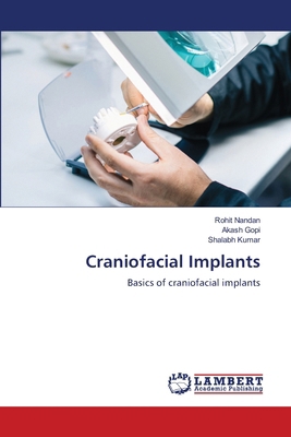 Craniofacial Implants 6209470033 Book Cover