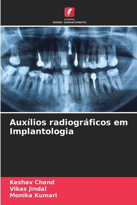 Auxílios radiográficos em Implantologia [Portuguese] 6208618142 Book Cover