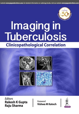 Imaging in Tuberculosis 9388958977 Book Cover