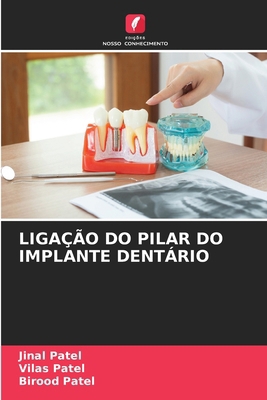 Ligação Do Pilar Do Implante Dentário [Portuguese] 6207763777 Book Cover