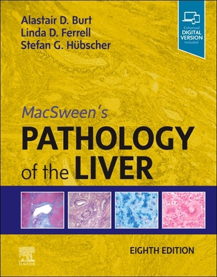 Macsween's Pathology of the Liver 0702082287 Book Cover