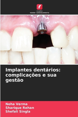 Implantes dentários: complicações e sua gestão [Portuguese] 6205760231 Book Cover