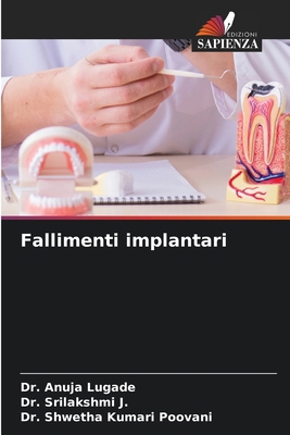 Fallimenti implantari [Italian] 6207967461 Book Cover