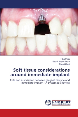 Soft tissue considerations around immediate imp... 6205502224 Book Cover