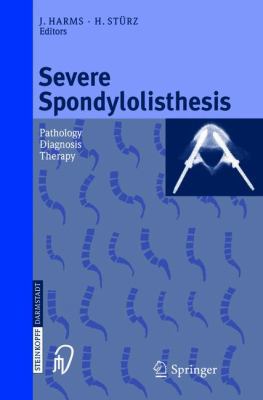 Severe Spondylolisthesis: Pathology - Diagnosis... 3798512531 Book Cover