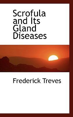 Scrofula and Its Gland Diseases 0554461196 Book Cover
