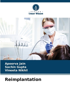 Reimplantation [German] 6200749191 Book Cover