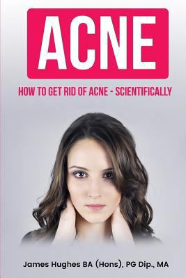 Acne: How to get rid of acne - scientifically 1974054675 Book Cover