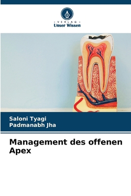 Management des offenen Apex [German] 620767331X Book Cover