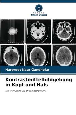 Kontrastmittelbildgebung in Kopf und Hals [German] 6204497022 Book Cover