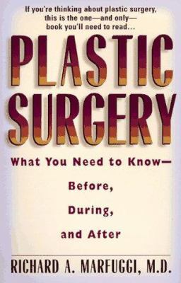 Plastic Surgery: What You Need to Know Before, ... 039952374X Book Cover