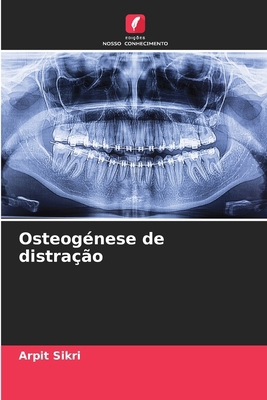 Osteogénese de distração [Portuguese] 6207876474 Book Cover
