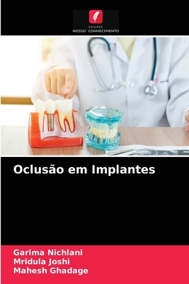 Oclusão em Implantes [Portuguese] 6203523534 Book Cover