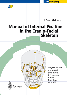 Manual of Internal Fixation in the Cranio-Facia... 3642637329 Book Cover