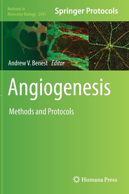 Angiogenesis: Methods and Protocols 1071620584 Book Cover
