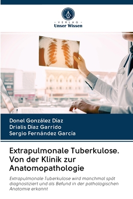 Extrapulmonale Tuberkulose. Von der Klinik zur ... [German] 6202895772 Book Cover