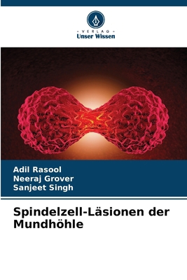 Spindelzell-Läsionen der Mundhöhle [German] 6207163664 Book Cover