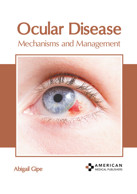 Ocular Disease: Mechanisms and Management B0CFQ8V4FR Book Cover