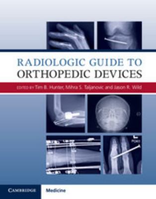 Radiologic Guide to Orthopedic Devices 1107085624 Book Cover