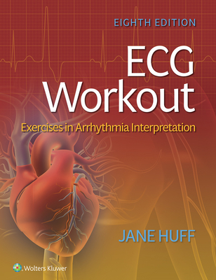 ECG Workout: Exercises in Arrhythmia Interpreta... 1975174542 Book Cover