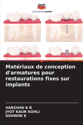 Matériaux de conception d'armatures pour restau... [French] 6136348381 Book Cover