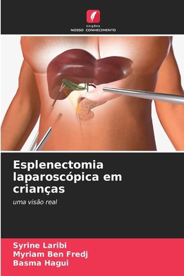 Esplenectomia laparoscópica em crianças [Portuguese] 6209075169 Book Cover