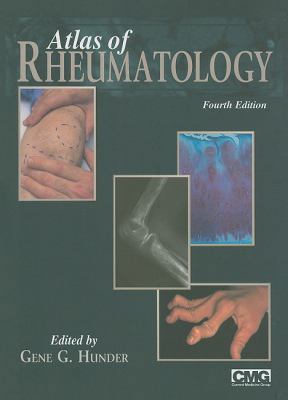 Atlas of Rheumatology 1573403571 Book Cover