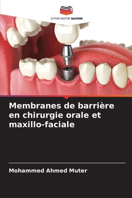 Membranes de barrière en chirurgie orale et max... [French] 6207776119 Book Cover