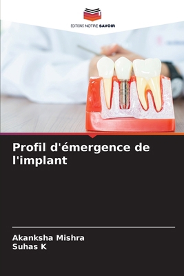 Profil d'émergence de l'implant [French] 6208343704 Book Cover
