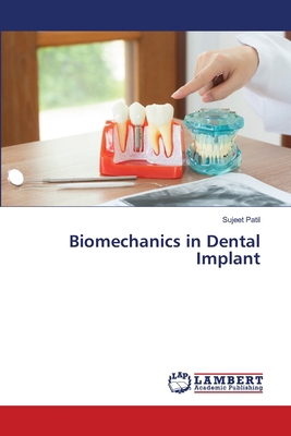 Biomechanics in Dental Implant 6208446449 Book Cover
