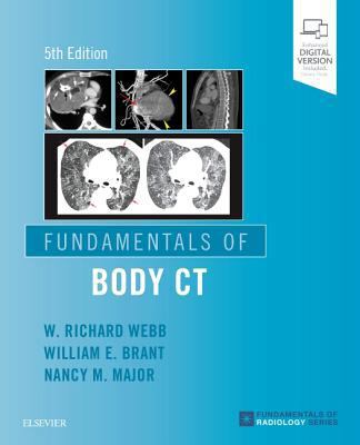 Fundamentals of Body CT 0323608329 Book Cover