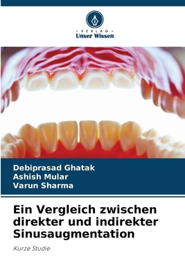 Ein Vergleich zwischen direkter und indirekter ... [German] 6207408950 Book Cover