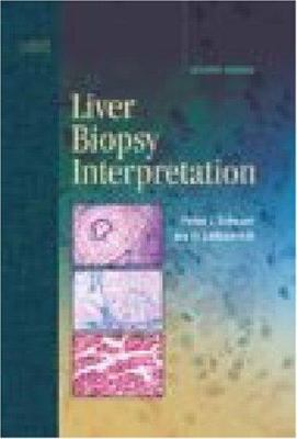 Liver Biopsy Interpretation 1416026215 Book Cover