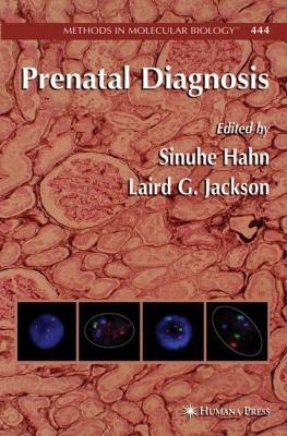 Prenatal Diagnosis 1617377872 Book Cover