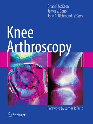 Knee Arthroscopy 146141055X Book Cover
