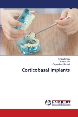 Corticobasal Implants 3659802662 Book Cover