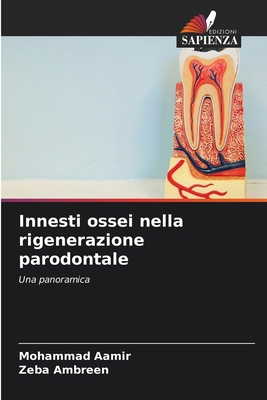 Innesti ossei nella rigenerazione parodontale [Italian] 6208634679 Book Cover