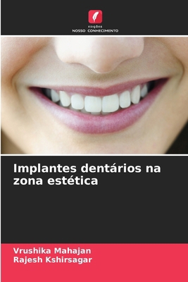 Implantes dentários na zona estética [Portuguese] 6207259696 Book Cover