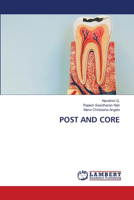 Post and Core 620765367X Book Cover