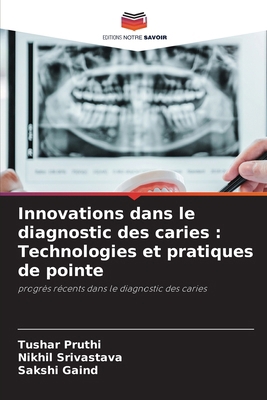 Innovations dans le diagnostic des caries: Tech... [French] 6203614149 Book Cover