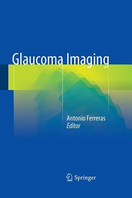 Glaucoma Imaging 3319365630 Book Cover