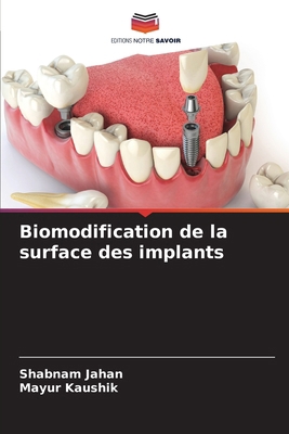 Biomodification de la surface des implants [French] 6206869830 Book Cover