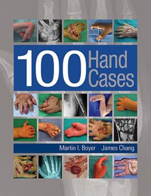 100 Hand Cases 1626236607 Book Cover