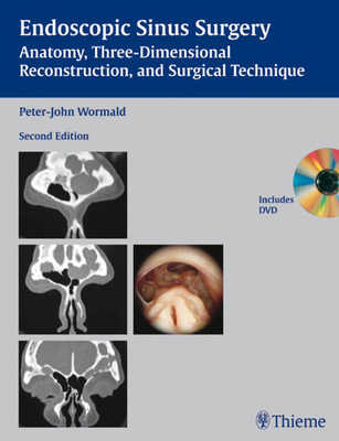 Endoscopic Sinus Surgery: Anatomy, Three-Dimens... 1588906035 Book Cover