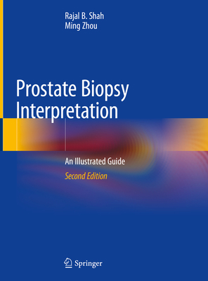 Prostate Biopsy Interpretation: An Illustrated ... 3030136000 Book Cover