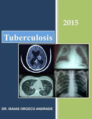 Tuberculosis 2015 [Spanish] 1515192032 Book Cover