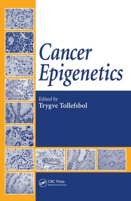 Cancer Epigenetics 1420045792 Book Cover