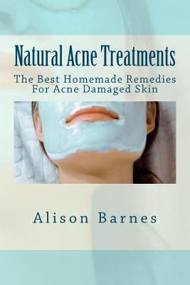 Natural Acne Treatments: The Best Homemade Reme... 147522222X Book Cover