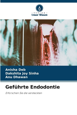 Geführte Endodontie [German] 6207547128 Book Cover