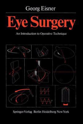 Eye Surgery: An Introduction to Operative Techn... 3540099220 Book Cover